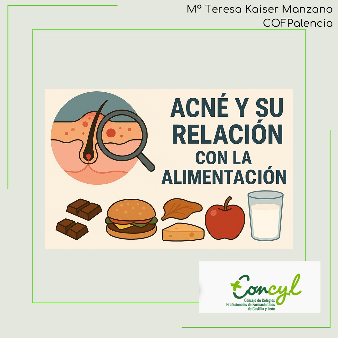 Alimentación y Acné 1